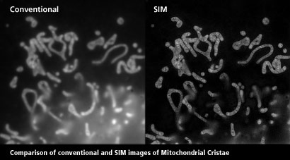 Conventional vs. N-SIM